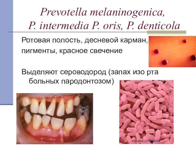 Prevotella melaninogenica, P. intermedia P. oris, P. denticola Ротовая полость, десневой карман,