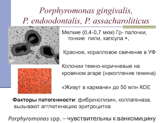 Porphyromonas gingivalis, P. endoodontalis, P. assacharoliticus Мелкие (0,4-0,7 мкм) Гр- палочки, тонкие