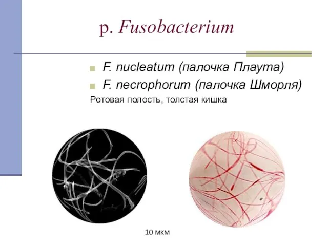 p. Fusobacterium F. nucleatum (палочка Плаута) F. necrophorum (палочка Шморля) Ротовая полость, толстая кишка 10 мкм