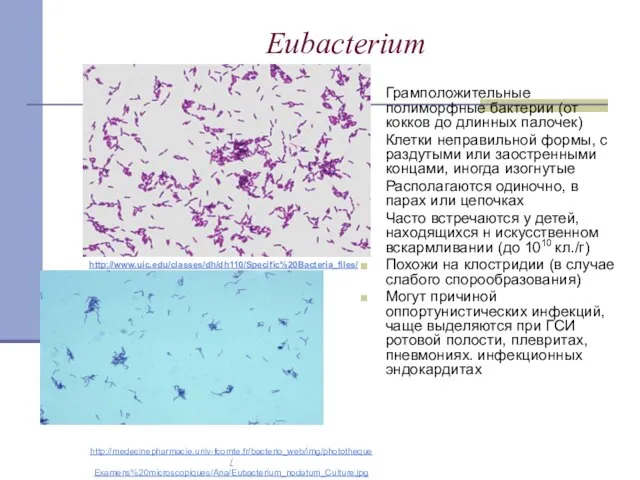 Eubacterium Грамположительные полиморфные бактерии (от кокков до длинных палочек) Клетки неправильной формы,