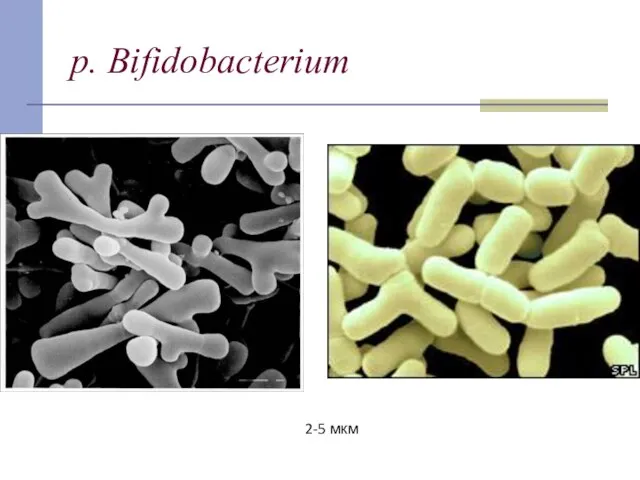 p. Bifidobacterium 2-5 мкм