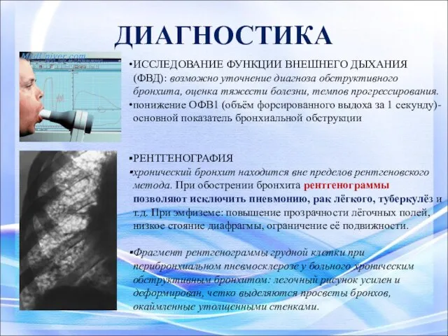 ДИАГНОСТИКА ИССЛЕДОВАНИЕ ФУНКЦИИ ВНЕШНЕГО ДЫХАНИЯ (ФВД): возможно уточнение диагноза обструктивного бронхита, оценка