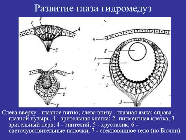 Развитие глаза гидромедуз Слева вверху - глазное пятно; слева внизу - глазная