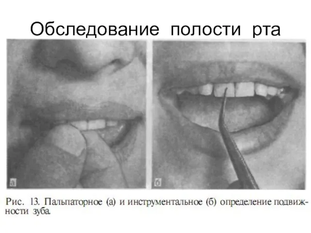 Обследование полости рта