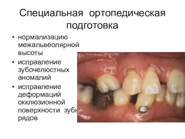 Специальная ортопедическая подготовка нормализацию межальвеолярной высоты исправление зубочелюстных аномалий исправление деформаций окклюзионной поверхности зубных рядов