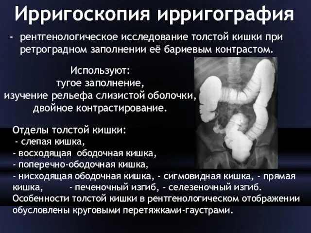 Ирригоскопия ирригография рентгенологическое исследование толстой кишки при ретроградном заполнении её бариевым контрастом.