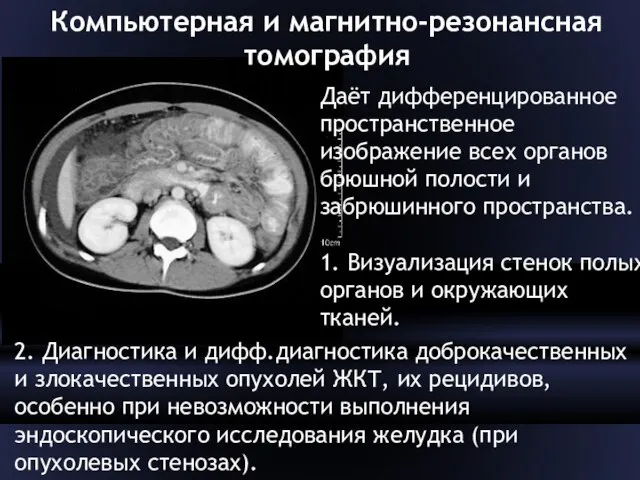 Компьютерная и магнитно-резонансная томография Даёт дифференцированное пространственное изображение всех органов брюшной полости