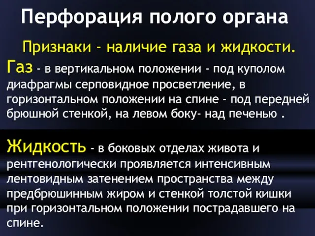 Перфорация полого органа Признаки - наличие газа и жидкости. Газ - в