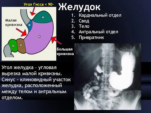 Желудок Кардиальный отдел Свод Тело Антральный отдел Привратник Угол Гисса Малая кривизна