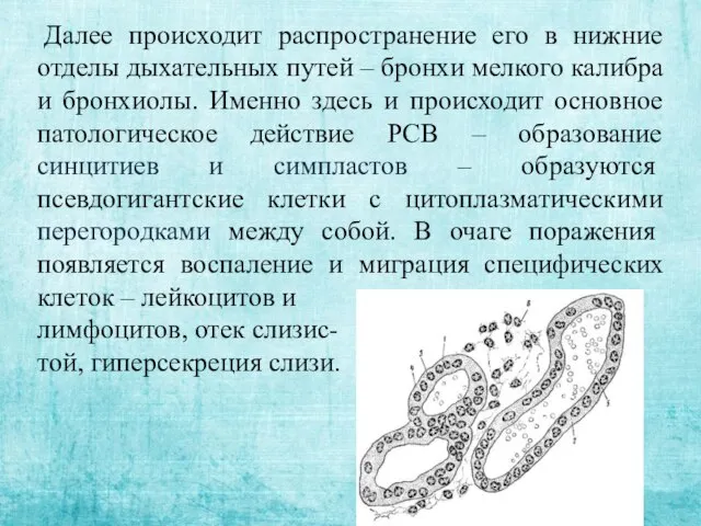 Далее происходит распространение его в нижние отделы дыхательных путей – бронхи мелкого