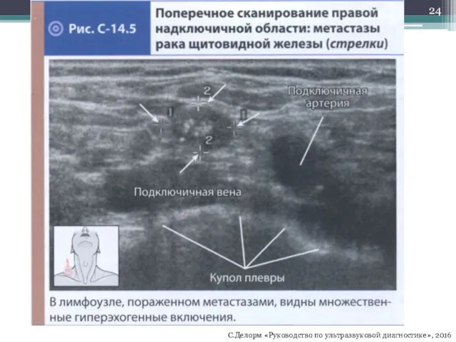 С.Делорм «Руководство по ультразвуковой диагностике», 2016