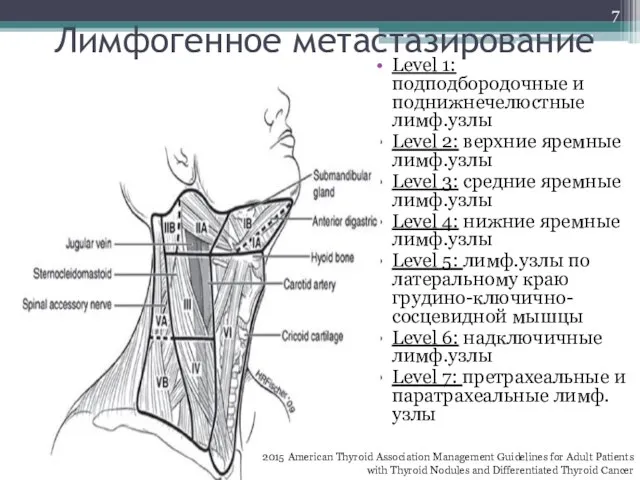 Лимфогенное метастазирование Level 1: подподбородочные и поднижнечелюстные лимф.узлы Level 2: верхние яремные