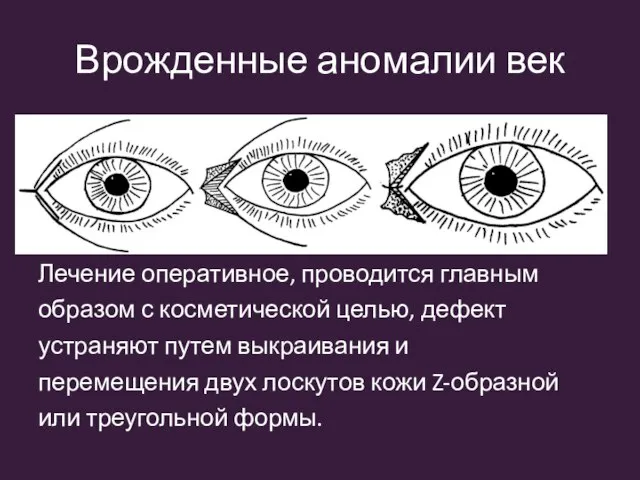 Врожденные аномалии век Лечение оперативное, проводится главным образом с косметической целью, дефект