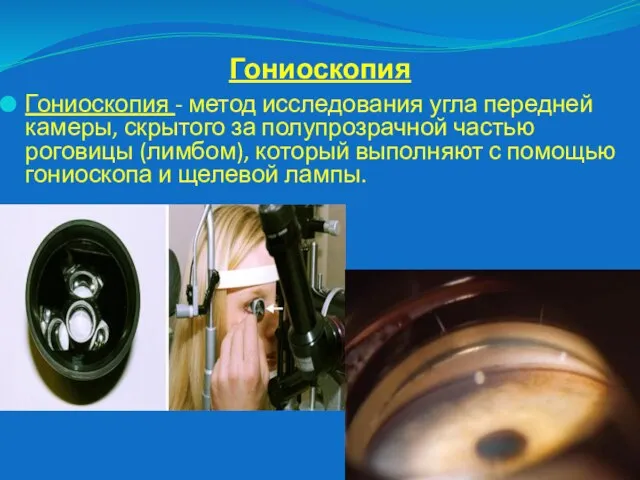 Гониоскопия Гониоскопия - метод исследования угла передней камеры, скрытого за полупрозрачной частью