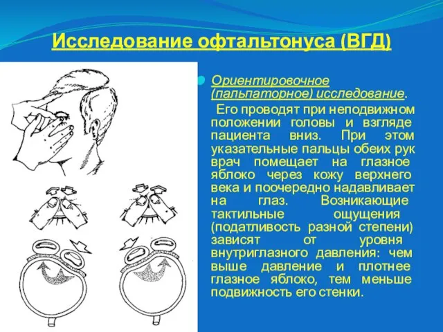 Исследование офтальтонуса (ВГД) Ориентировочное (пальпаторное) исследование. Его проводят при неподвижном положении головы