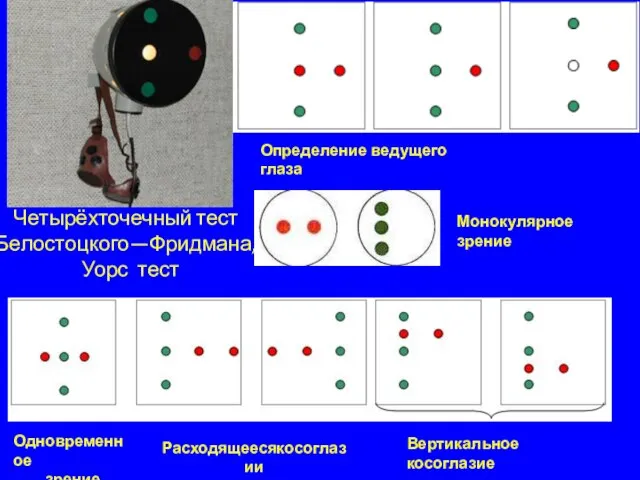 Четырёхточечный тест Белостоцкого—Фридмана, Уорс тест Определение ведущего глаза Монокулярное зрение Расходящеесякосоглазии Вертикальное косоглазие Одновременное зрение