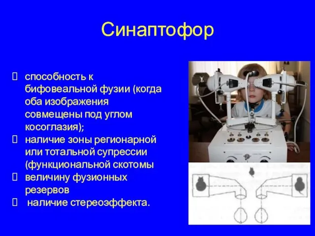 Синаптофор способность к бифовеальной фузии (когда оба изображения совмещены под углом косоглазия);