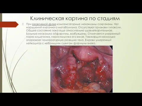 Клиническая картина по стадиям При реактивной фазе компенсаторные механизмы сохранены. Нет нарушений