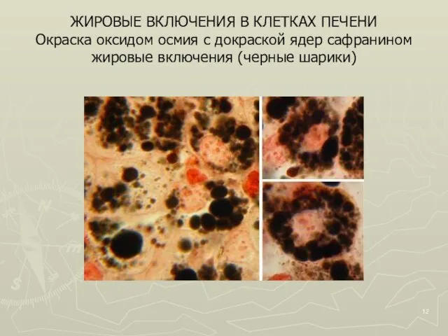 ЖИРОВЫЕ ВКЛЮЧЕНИЯ В КЛЕТКАХ ПЕЧЕНИ Окраска оксидом осмия с докраской ядер сафранином жировые включения (черные шарики)