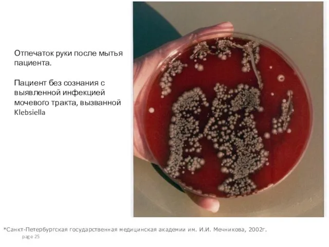 page Отпечаток руки после мытья пациента. Пациент без сознания с выявленной инфекцией