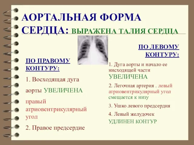 АОРТАЛЬНАЯ ФОРМА СЕРДЦА: ВЫРАЖЕНА ТАЛИЯ СЕРДЦА ПО ЛЕВОМУ КОНТУРУ: 1. Дуга аорты