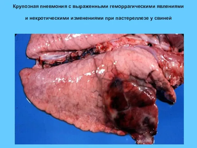 Крупозная пневмония с выраженными геморрагическими явлениями и некротическими изменениями при пастереллезе у свиней