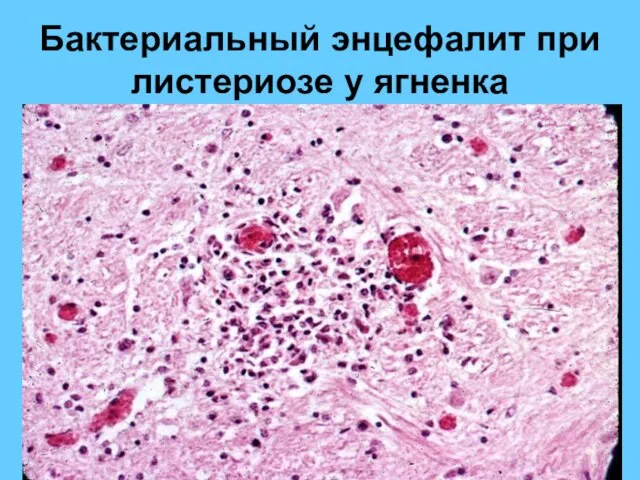 Бактериальный энцефалит при листериозе у ягненка