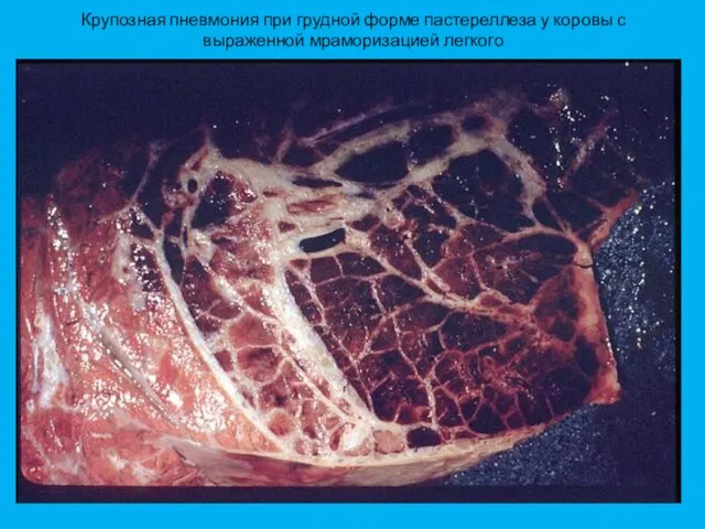 Крупозная пневмония при грудной форме пастереллеза у коровы с выраженной мраморизацией легкого