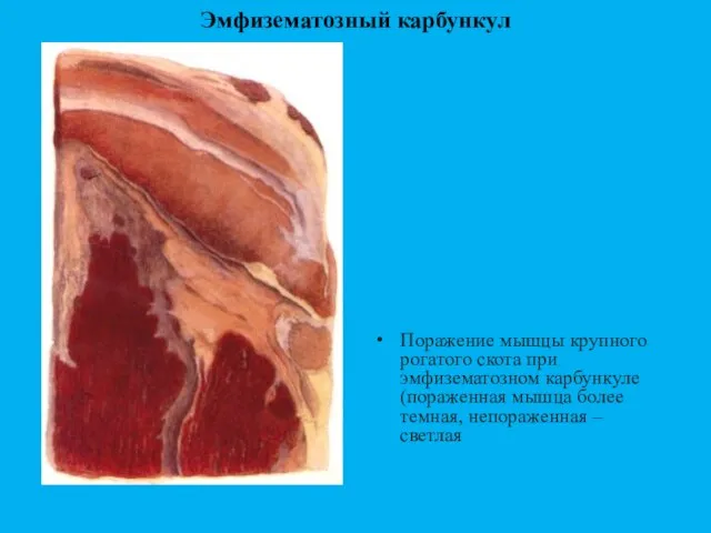 Эмфизематозный карбункул Поражение мышцы крупного рогатого скота при эмфизематозном карбункуле (пораженная мышца