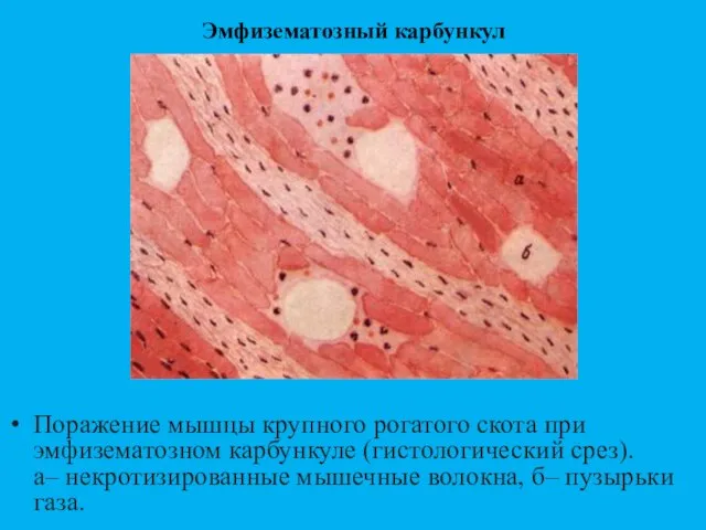 Эмфизематозный карбункул Поражение мышцы крупного рогатого скота при эмфизематозном карбункуле (гистологический срез).