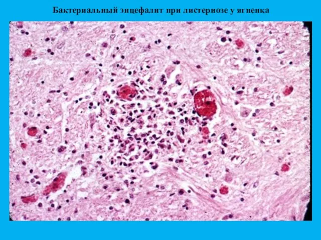 Бактериальный энцефалит при листериозе у ягненка