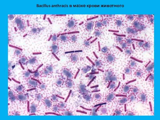 Bacillus anthracis в мазке крови животного