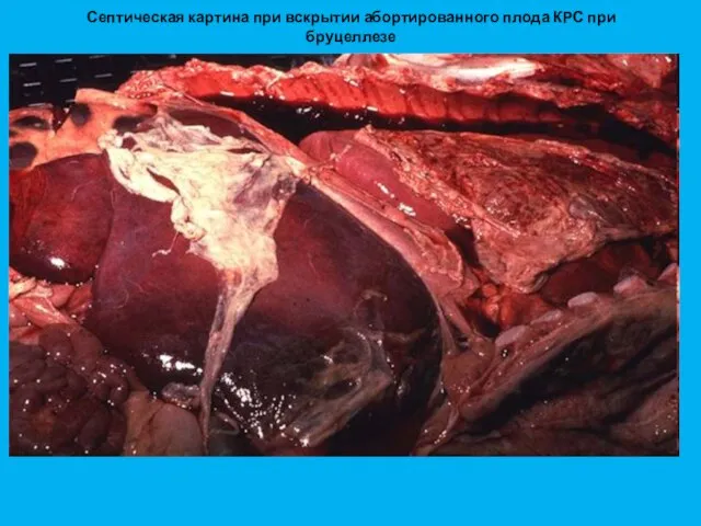 Септическая картина при вскрытии абортированного плода КРС при бруцеллезе
