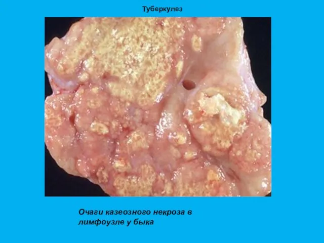 Туберкулез Очаги казеозного некроза в лимфоузле у быка