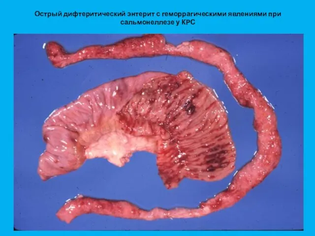 Острый дифтеритический энтерит с геморрагическими явлениями при сальмонеллезе у КРС