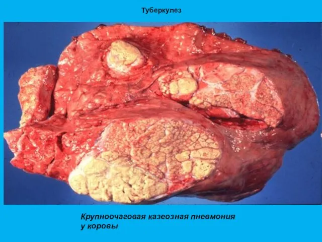 Туберкулез Крупноочаговая казеозная пневмония у коровы