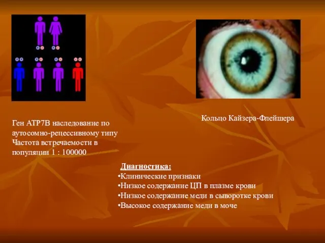 Ген АТР7В наследование по аутосомно-рецессивному типу Частота встречаемости в популяции 1 :