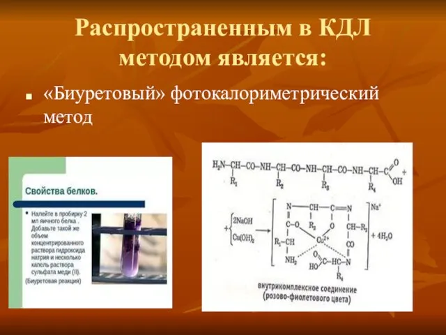 Распространенным в КДЛ методом является: «Биуретовый» фотокалориметрический метод