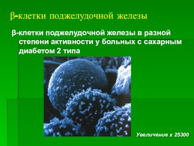 β-клетки поджелудочной железы β-клетки поджелудочной железы в разной степени активности у больных