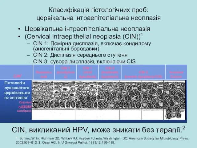 Класифікація гістологічних проб: цервікальна інтраепітеліальна неоплазія Цервікальна інтраепітеліальна неоплазія (Cervical intraepithelial neoplasia