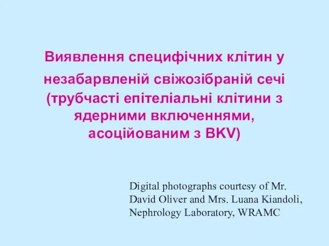 Виявлення специфічних клітин у незабарвленій свіжозібраній сечі (трубчасті епітеліальні клітини з ядерними