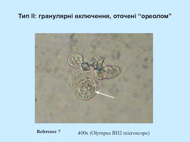 Тип II: гранулярні включення, оточені “ореолом” 400x (Olympus BH2 microscope) Reference 7