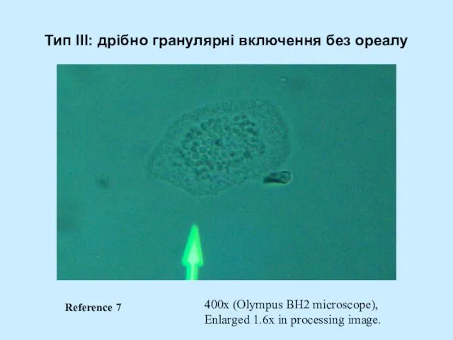 Тип III: дрібно гранулярні включення без ореалу 400x (Olympus BH2 microscope), Enlarged