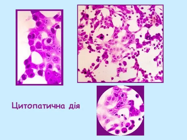 Цитопатична дія