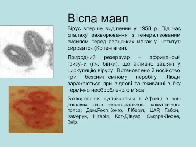 Віспа мавп Вірус вперше виділений у 1958 р. Під час спалаху захворювання