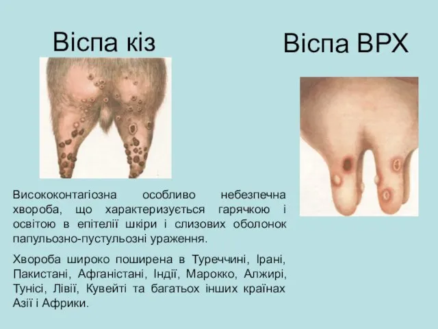 Віспа кіз Віспа ВРХ Висококонтагіозна особливо небезпечна хвороба, що характеризується гарячкою і