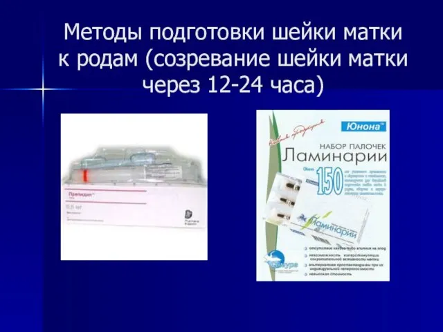 Методы подготовки шейки матки к родам (созревание шейки матки через 12-24 часа)