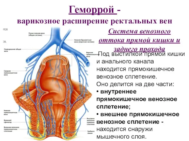 Геморрой - варикозное расширение ректальных вен Система венозного оттока прямой кишки и