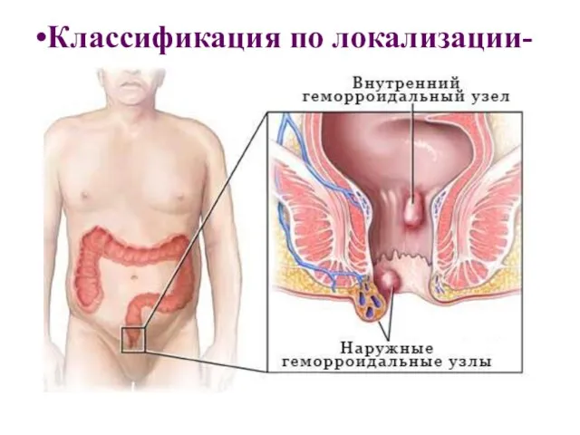 Классификация по локализации-