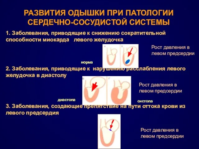 РАЗВИТИЯ ОДЫШКИ ПРИ ПАТОЛОГИИ СЕРДЕЧНО-СОСУДИСТОЙ СИСТЕМЫ 1. Заболевания, приводящие к снижению сократительной